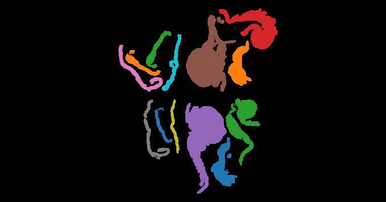 Spatially defined multicellular functional units in colorectal cancer revealed from single cell and spatial transcriptomics
