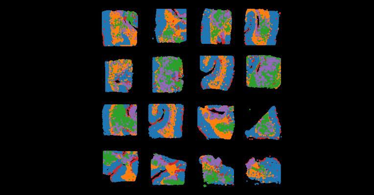 4D marmoset brain map reveals MRI and molecular signatures for onset of multiple sclerosis–like lesions