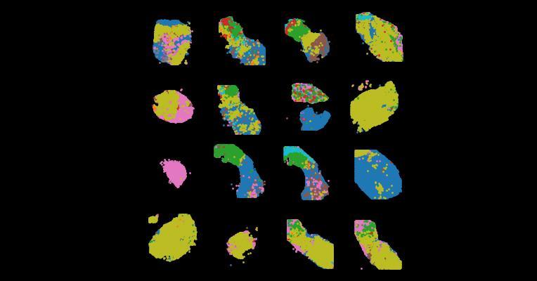 Mapping single-cell transcriptomes in the intra-tumoral and associated territories of kidney cancer