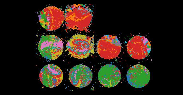 Spatially defined multicellular functional units in colorectal cancer revealed from single cell and spatial transcriptomics