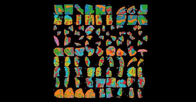Single-cell spatial transcriptomic analysis of human skin anatomy