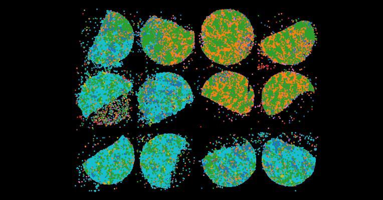 An atlas of healthy and injured cell states and niches in the human kidney