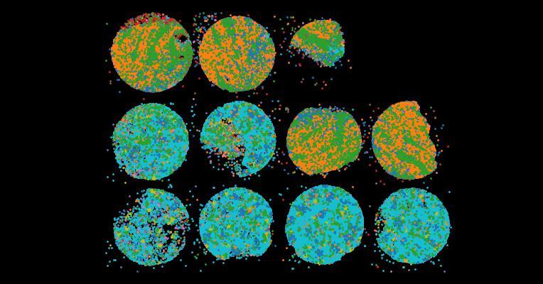 An atlas of healthy and injured cell states and niches in the human kidney