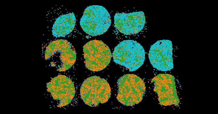 An atlas of healthy and injured cell states and niches in the human kidney