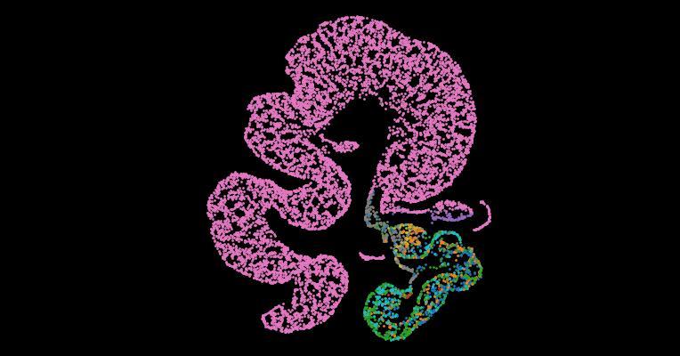 Tabula Sapiens 2.0: A comprehensive transcriptomic atlas of human cell types