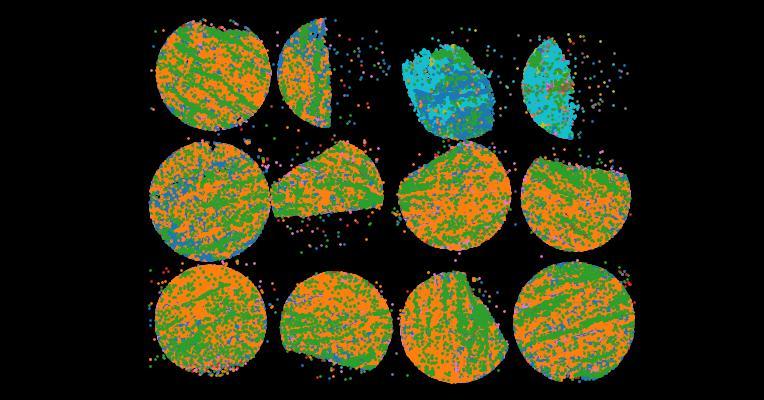 An atlas of healthy and injured cell states and niches in the human kidney